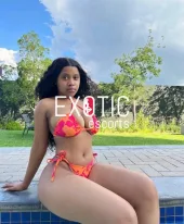 Sugar(Anal Available)